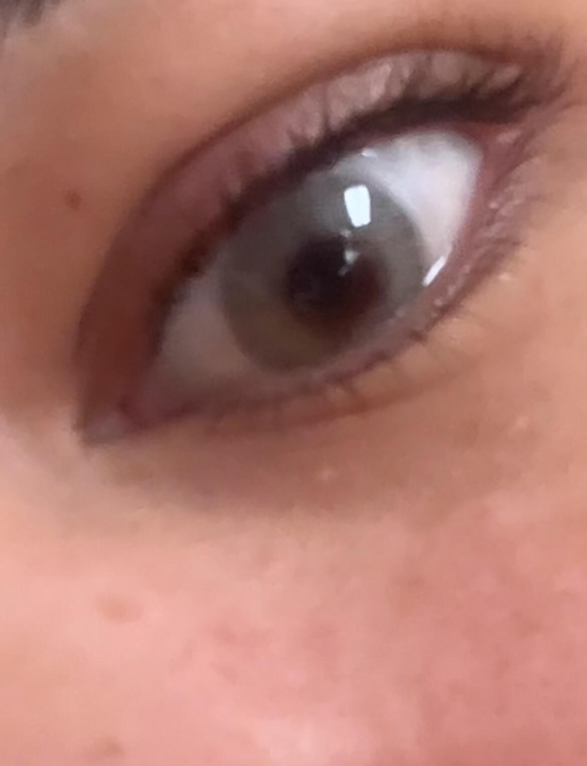 Customer photo: Lilia Grey lens on one eye next to her natural dark brown eye